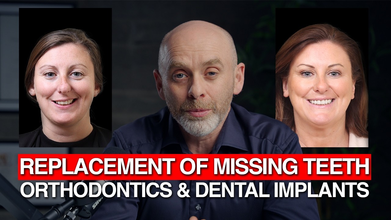 Replacement of missing teeth. Orthodontics & Dental implants| Orthodontics by Dr. Kieran Daly