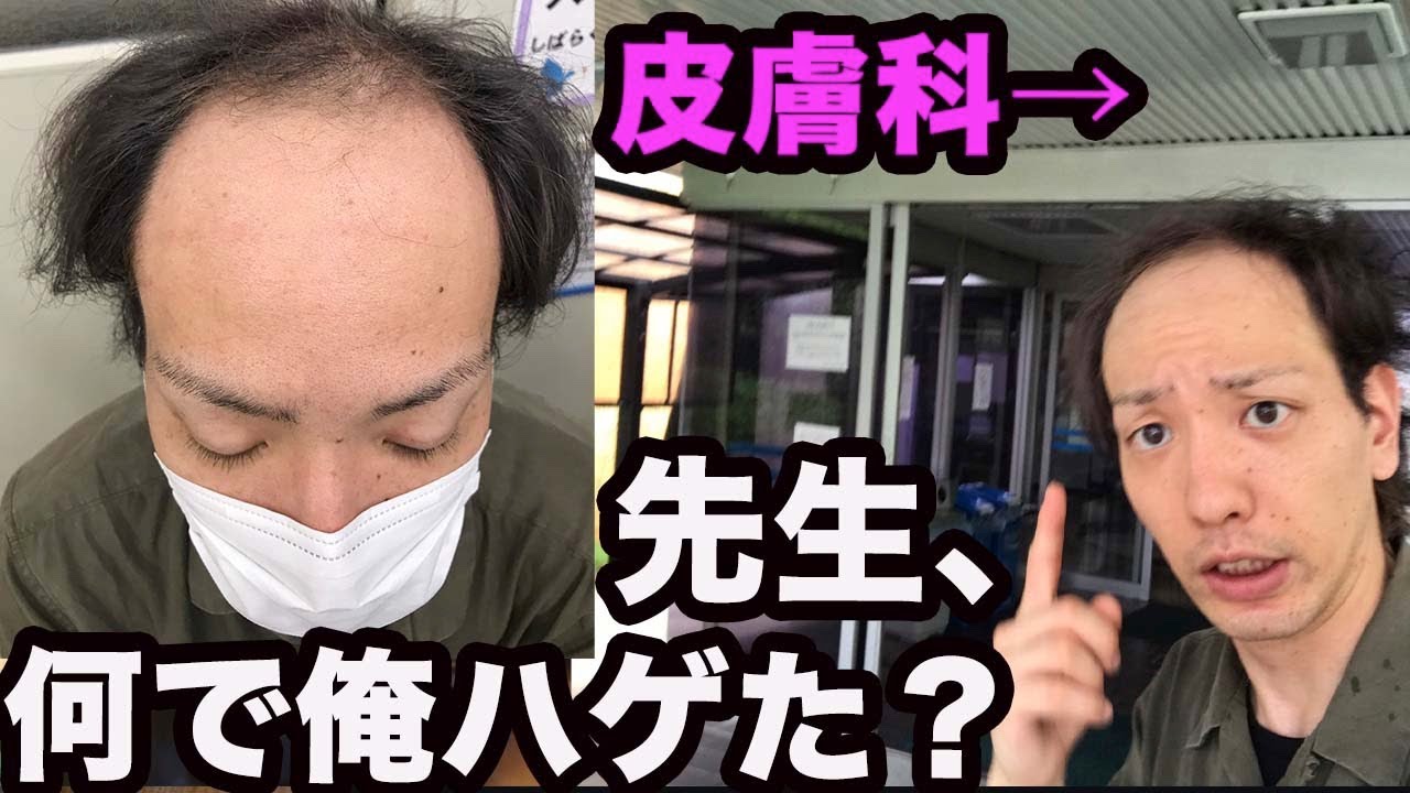 【若ハゲ】何故ハゲたか、皮膚科に聞いてみた