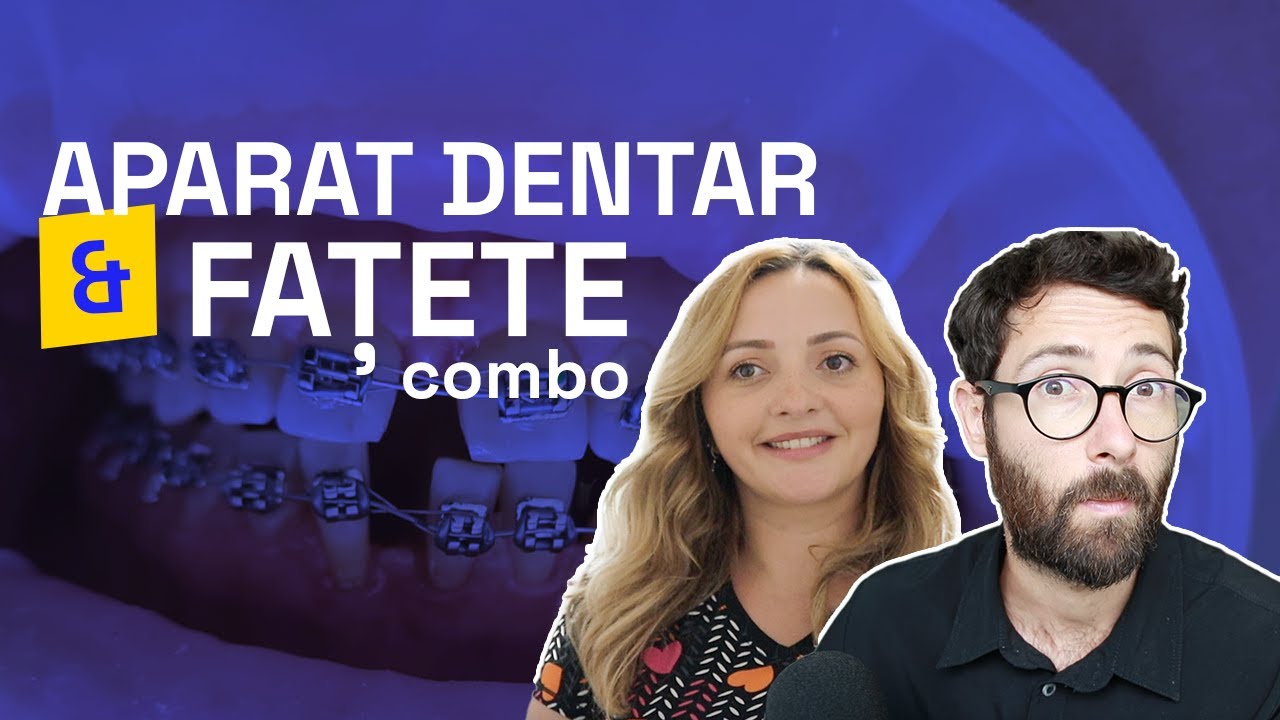I-AM PUS 12 FATETE DUPA APARAT DENTAR