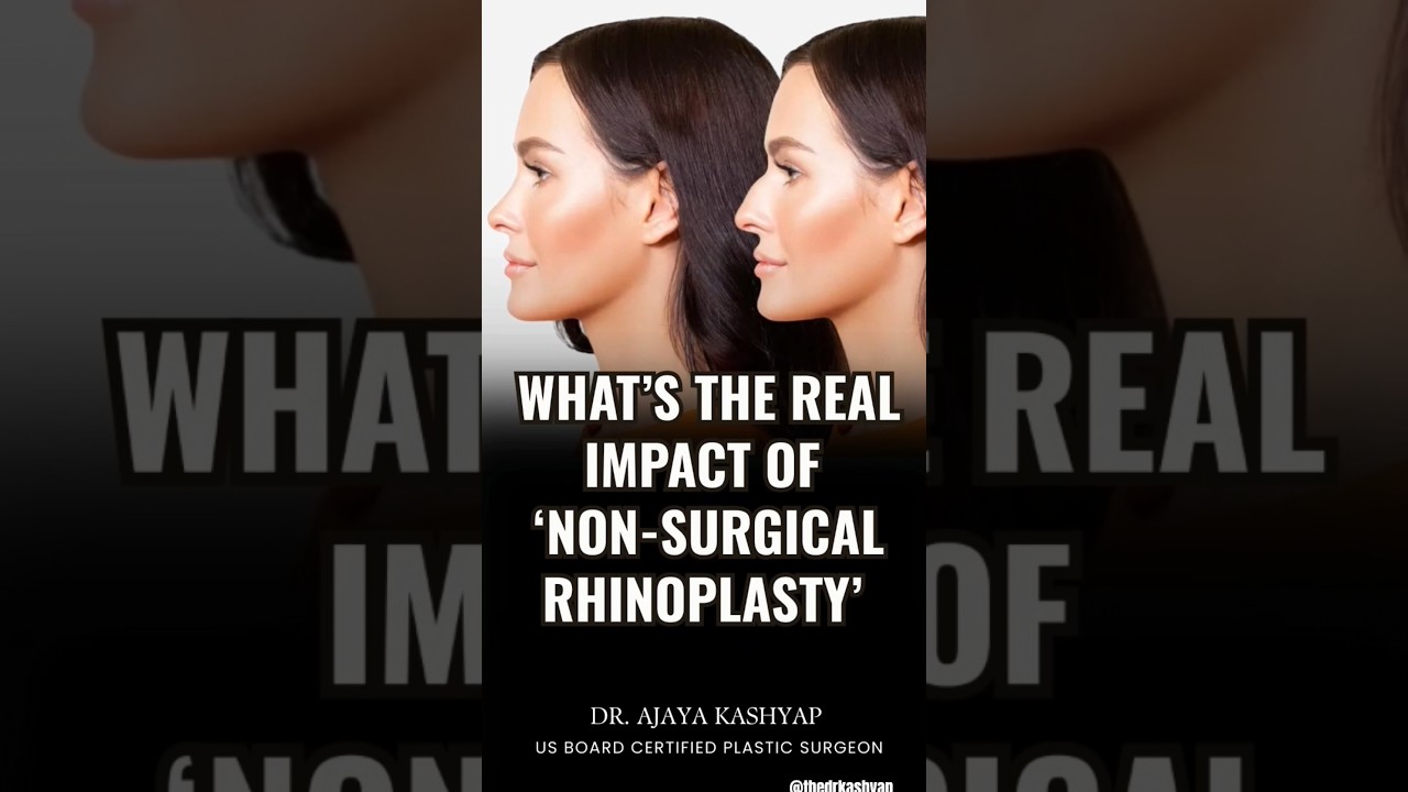 What&rsquo;s the Real Impact of &lsquo;Non-Surgical Rhinoplasty&rsquo;👃 #rhinoplasty #nonsurgical #ytshorts