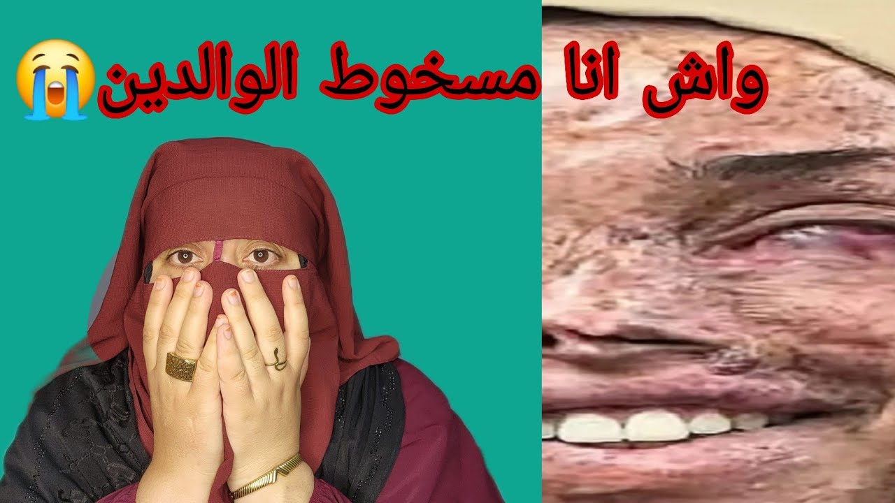 انا اللي كرهت الام ديالي بسباب وجهها اللي محروق😭 كما تدين تدان