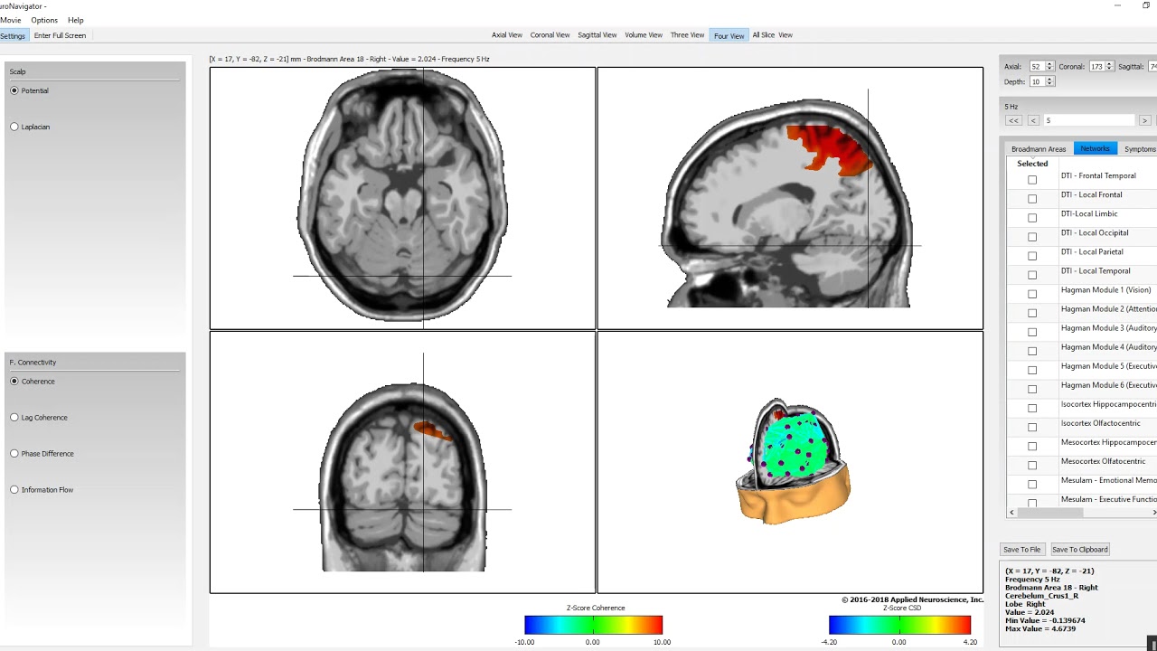 NeuroNavigator New Navigation Controls