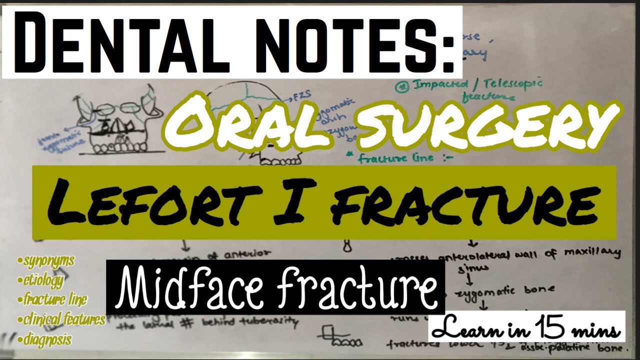 LEFORT I FRACTURE || MIDFACE FRACTURE || ORAL SURGERY || imp