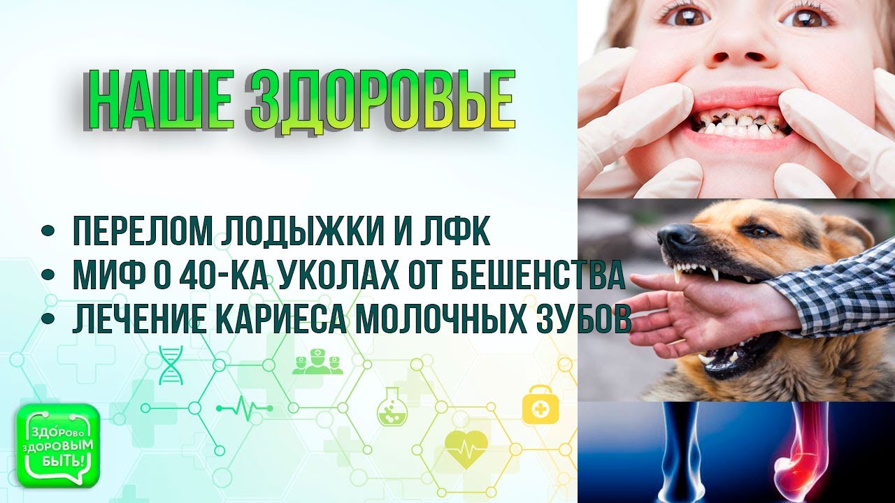 Перелом лодыжки | Миф о 40-ка уколах от бешенства | Лечение кариеса молочных зубов