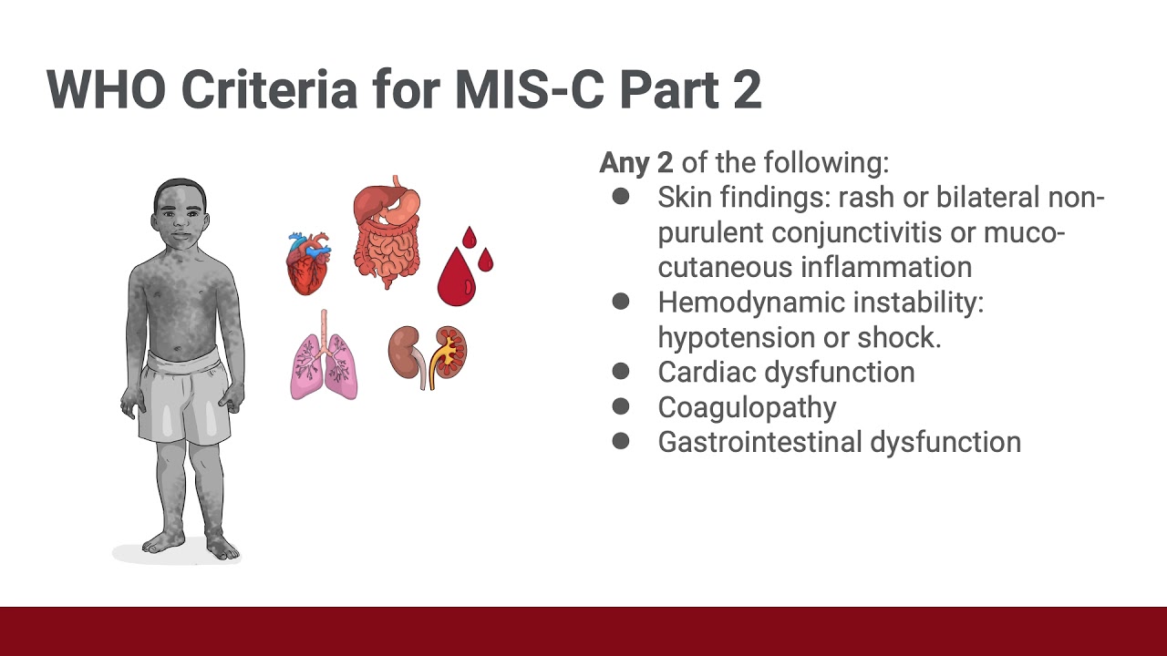 COVID-19 and Pediatrics: MIS-C