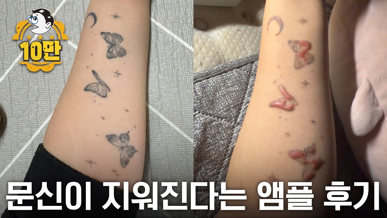6만원이면 문신이 지워진다는 앰플 써봤습니다 | 망한 문신 지워드립니다. EP.37