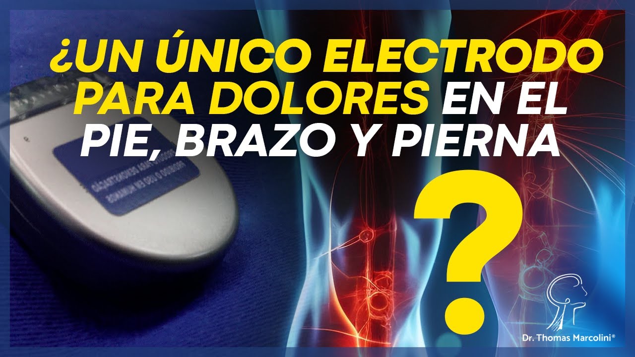 Dolor Complejo Regional en el Brazo y en las Piernas, &iquest;El Neuroestimulador DRG es Bueno?