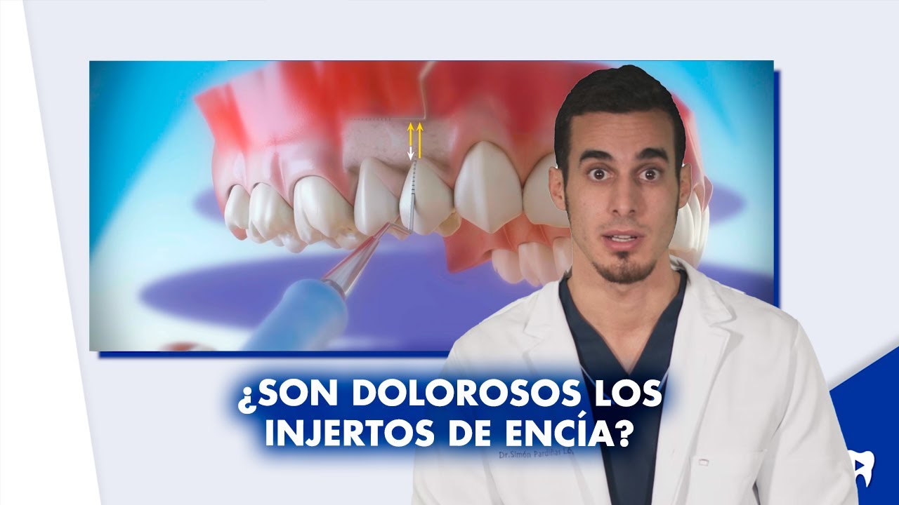 &iquest;Es doloroso el INJERTO DE ENC&Iacute;A? &iquest;Puede fracasar? | #Shorts
