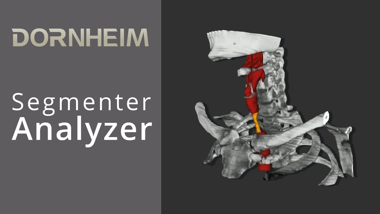 Segmenter Analyzer