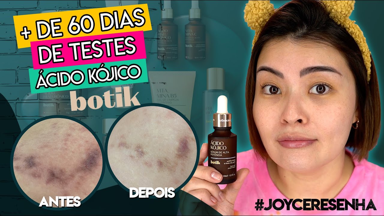 SÉRUM CLAREADOR DE ÁCIDO KÓJICO ✨ BOTIK✨ #JoyceResenha