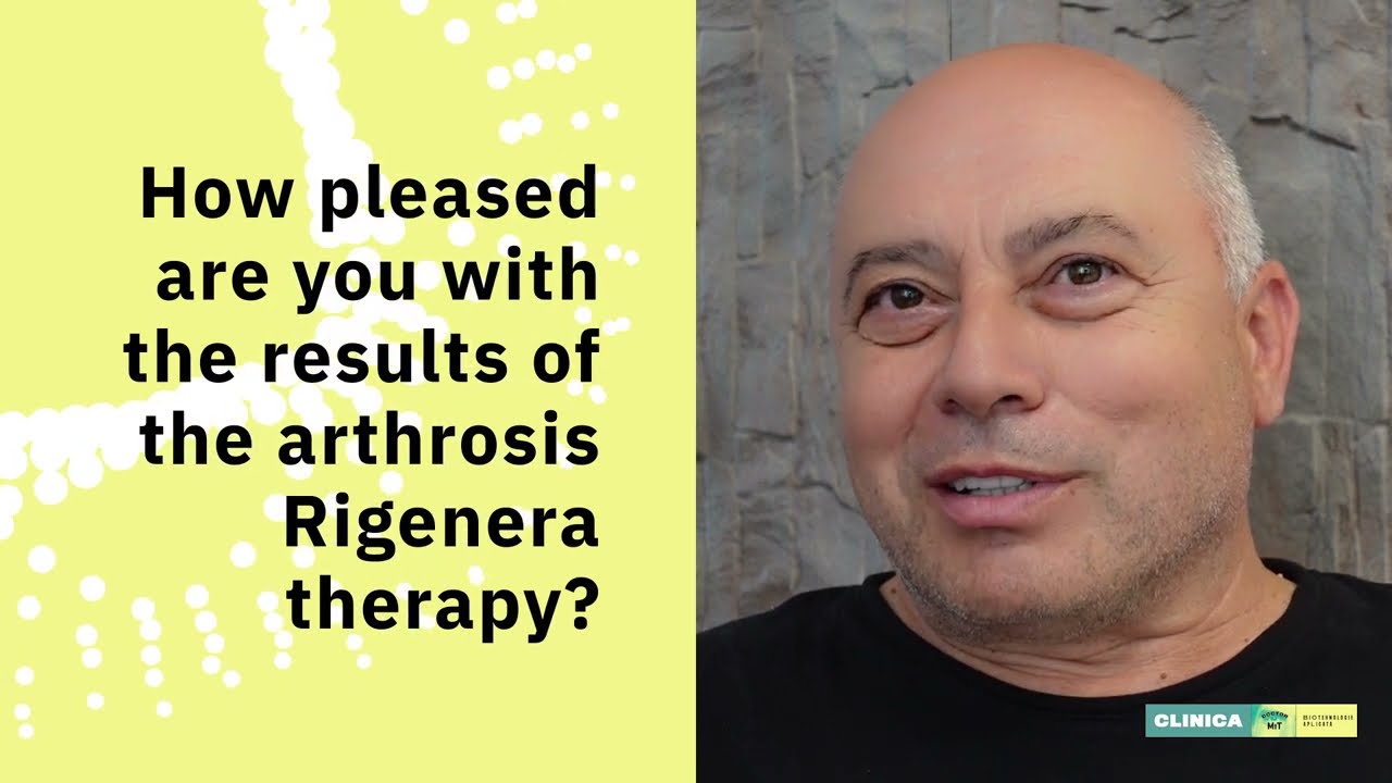 Rigenera treatment in arthrosis: what does the patient say after treatment?