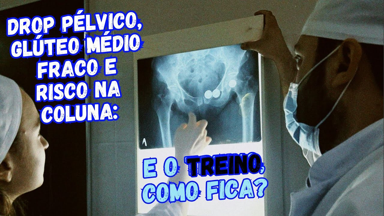 Da Biomecânica à Prescrição: Trendelenburg, Glúteo Médio e Proteção da Coluna