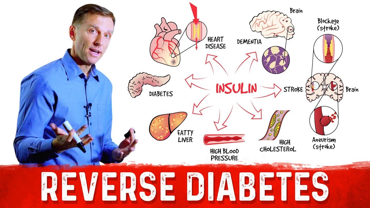 How to Reverse Damage from Diabetes?  &ndash; Dr.Berg on Reversing Diabetes