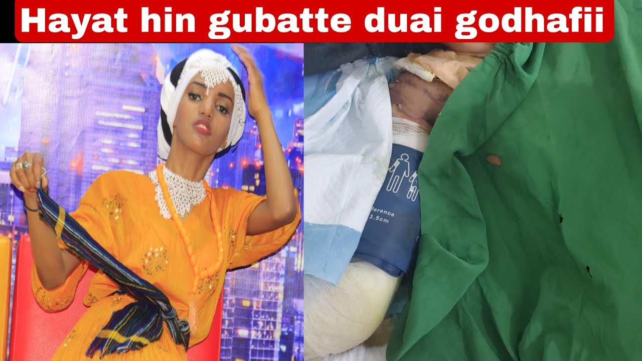 🛑warren hayat akkam jirti jettan?