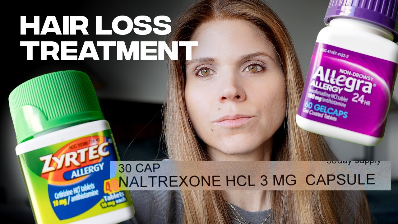 NALTREXONE & ANTIHISTAMINES FOR HAIR LOSS: The Less Known Treatments For Inflammatory Alopecia