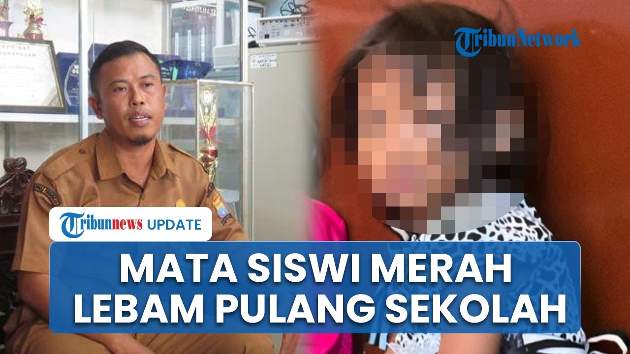 Mata Bocah SDN 150 Gandus Palembang Pulang dengan Mata Merah & Lebam, Wali Kota Turun Tangan