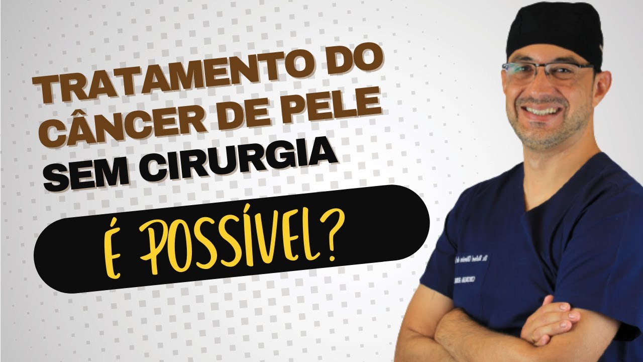 ✅ CÂNCER DE PELE SE TRATA SEM CIRURGIA? DESCUBRA comigo nesse vídeo