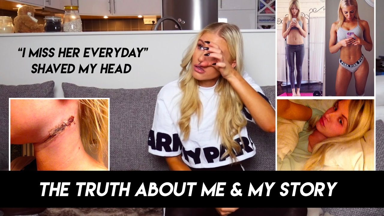 THE TRUTH ABOUT ME. MY STORY WITH CANCER & BEING SKINNY. - VLOG3