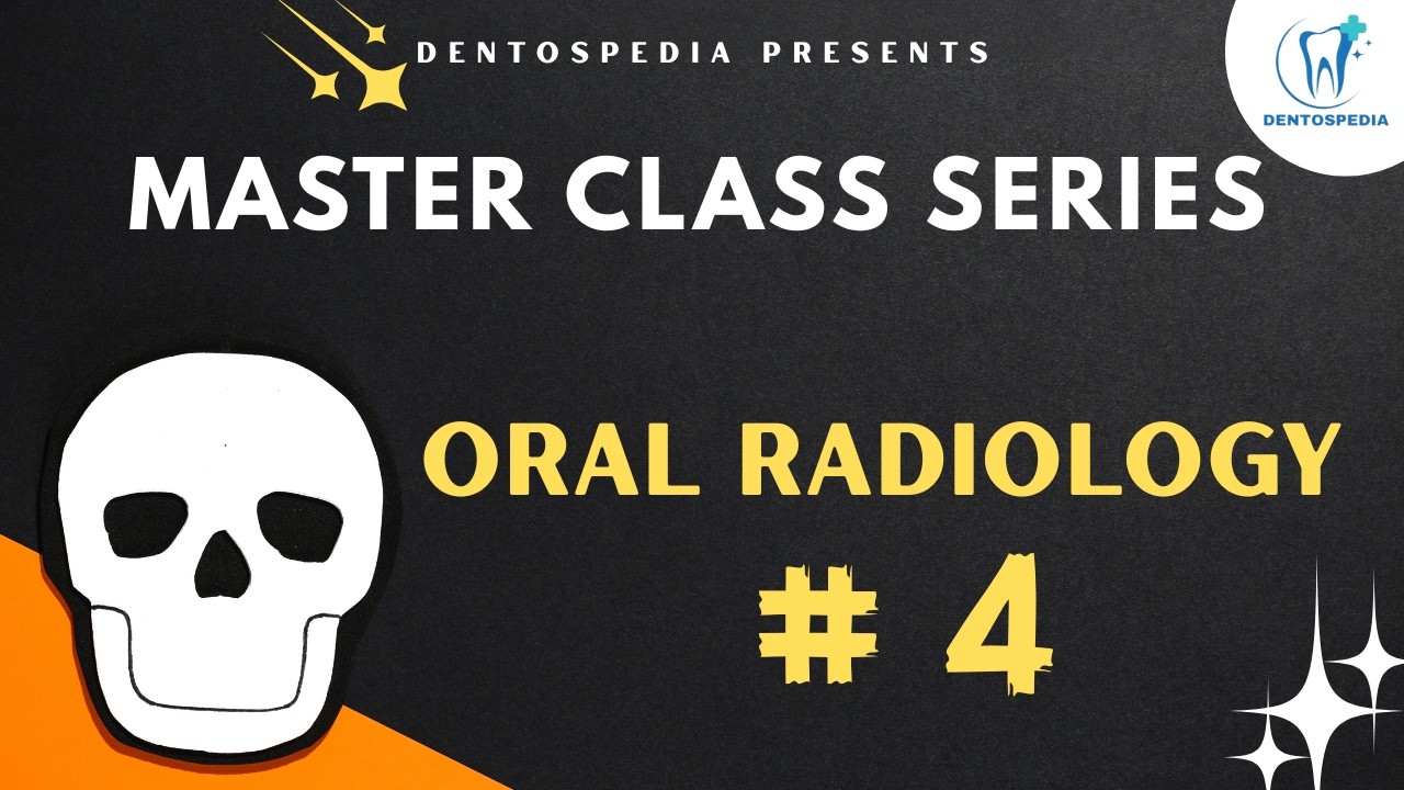 OR 4 Object Localization Technique Explained #oralradiology #oralradio #afk #inbde #lds #ore #mfds