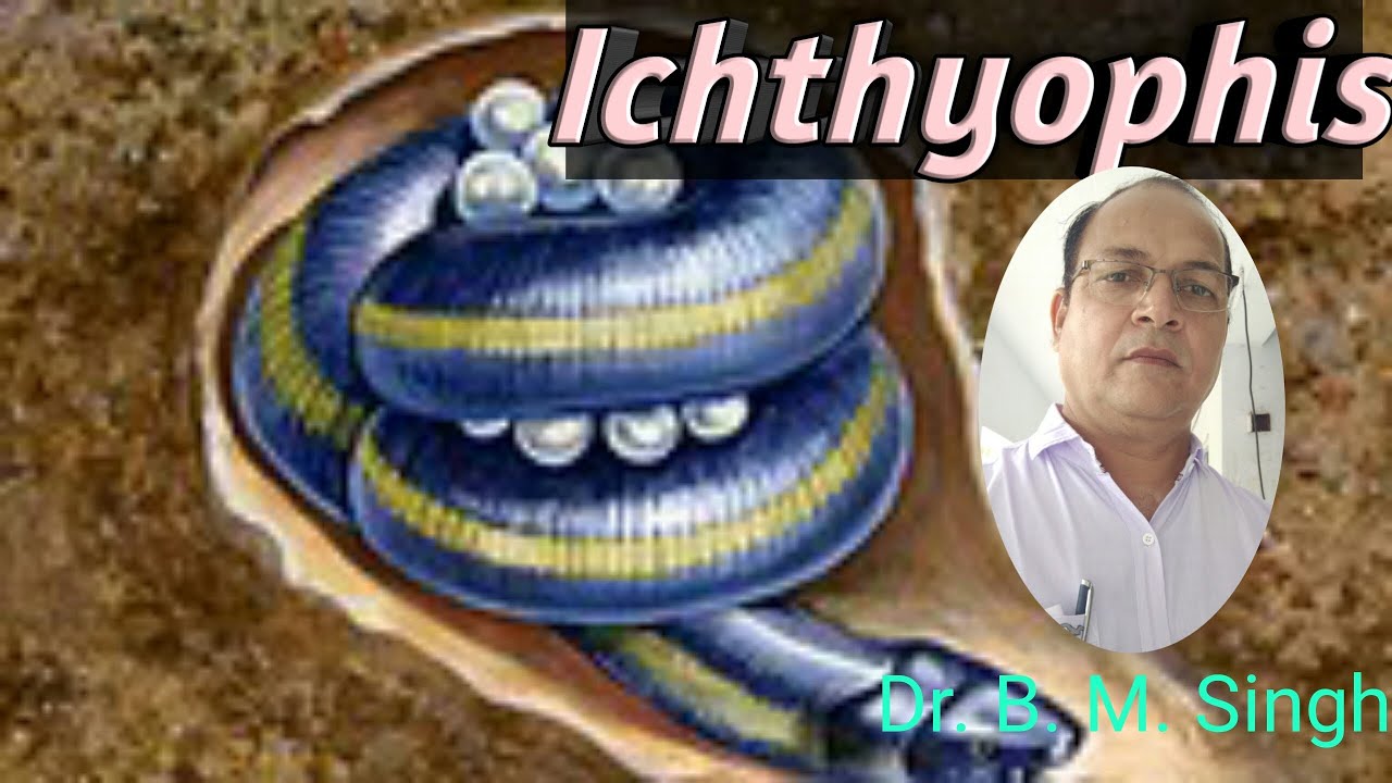 Ichthyophis