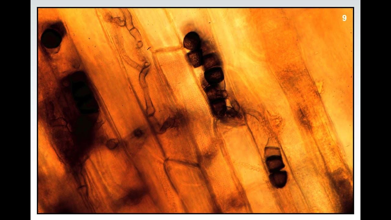 Fundamentals of Plant Diseases - Slide 9 - FUNGI:  SPORES