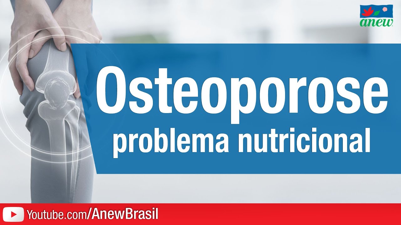 Osteoporose e Osteopenia - O Problema É Nutricional