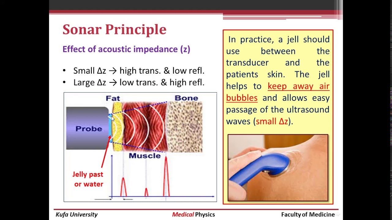 Medical Ultrasound