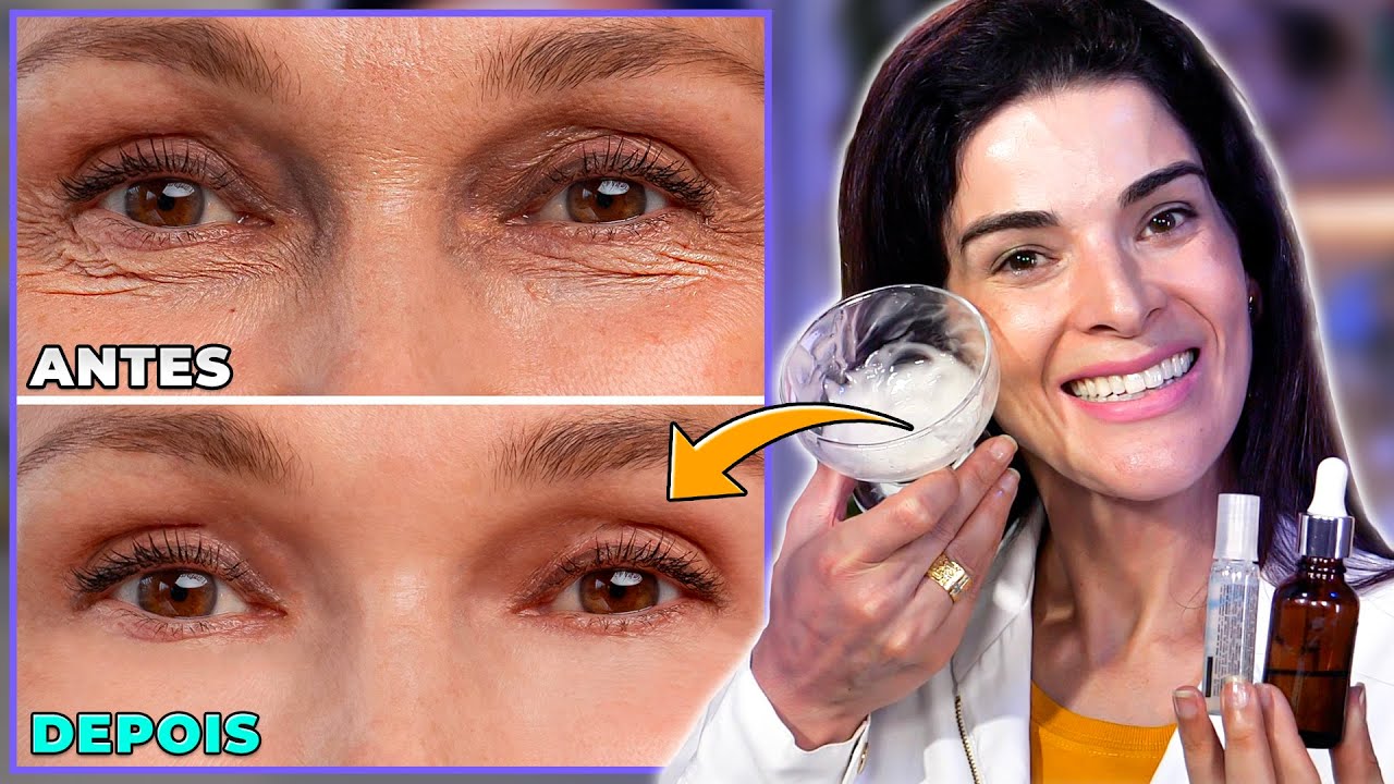 INCRÍVEL!!! 2 Opções que ACABAM COM A PELE MURCHA E COM RUGAS!