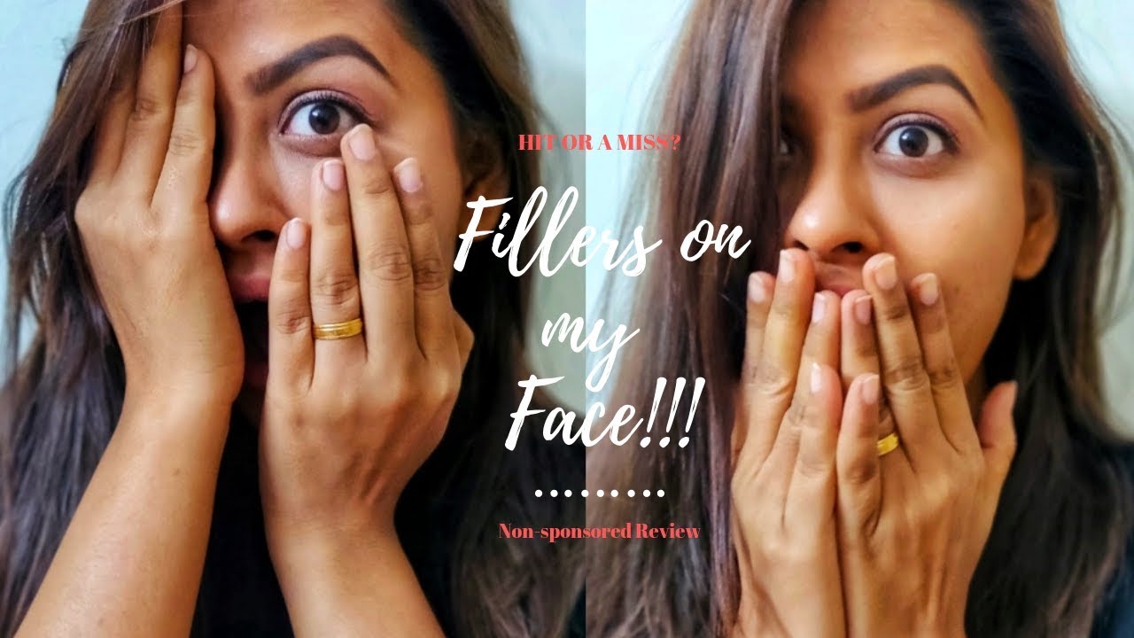 Tried Hyaluronic Acid Fillers on my Face!! | Indian Vlog| Kosmoderma Experience