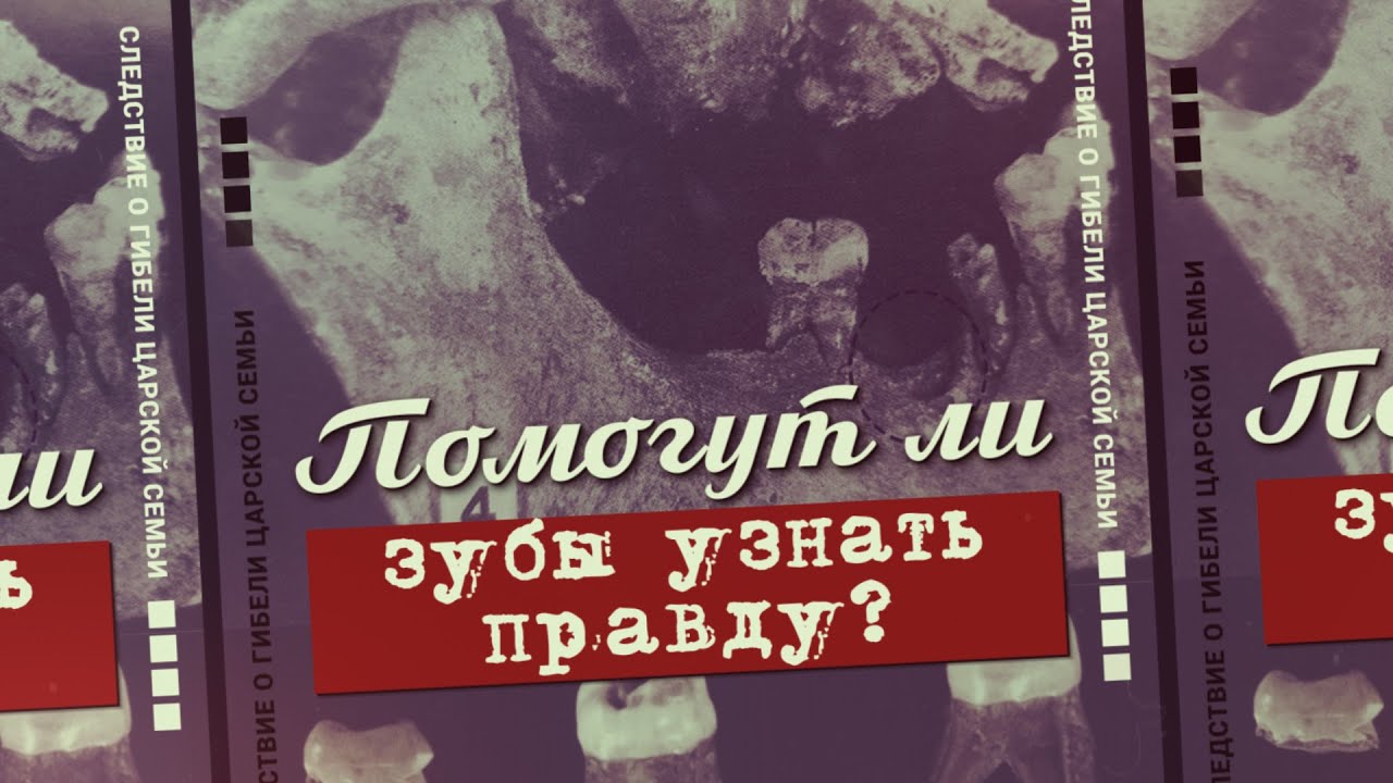 6. Помогут ли зубы узнать правду? Проект «Екатеринбургские останки»