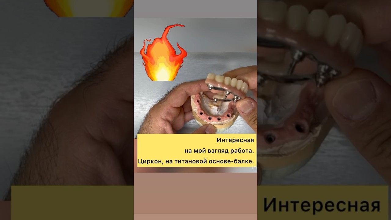 Цирконовая челюсть?😨🥶🔥 #шортс #зубы#медицина