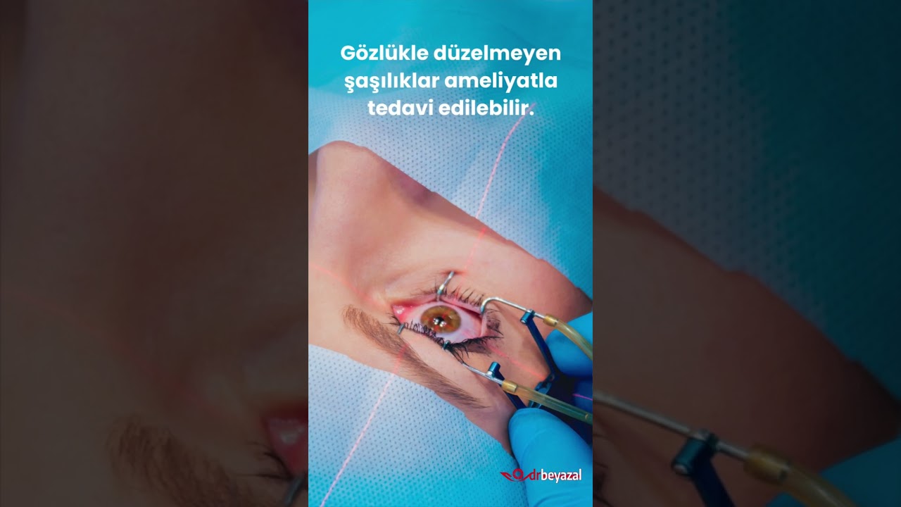 ŞAŞILIK VE GÖZ TEMBELLİĞİ NEDİR? 1. Bölüm