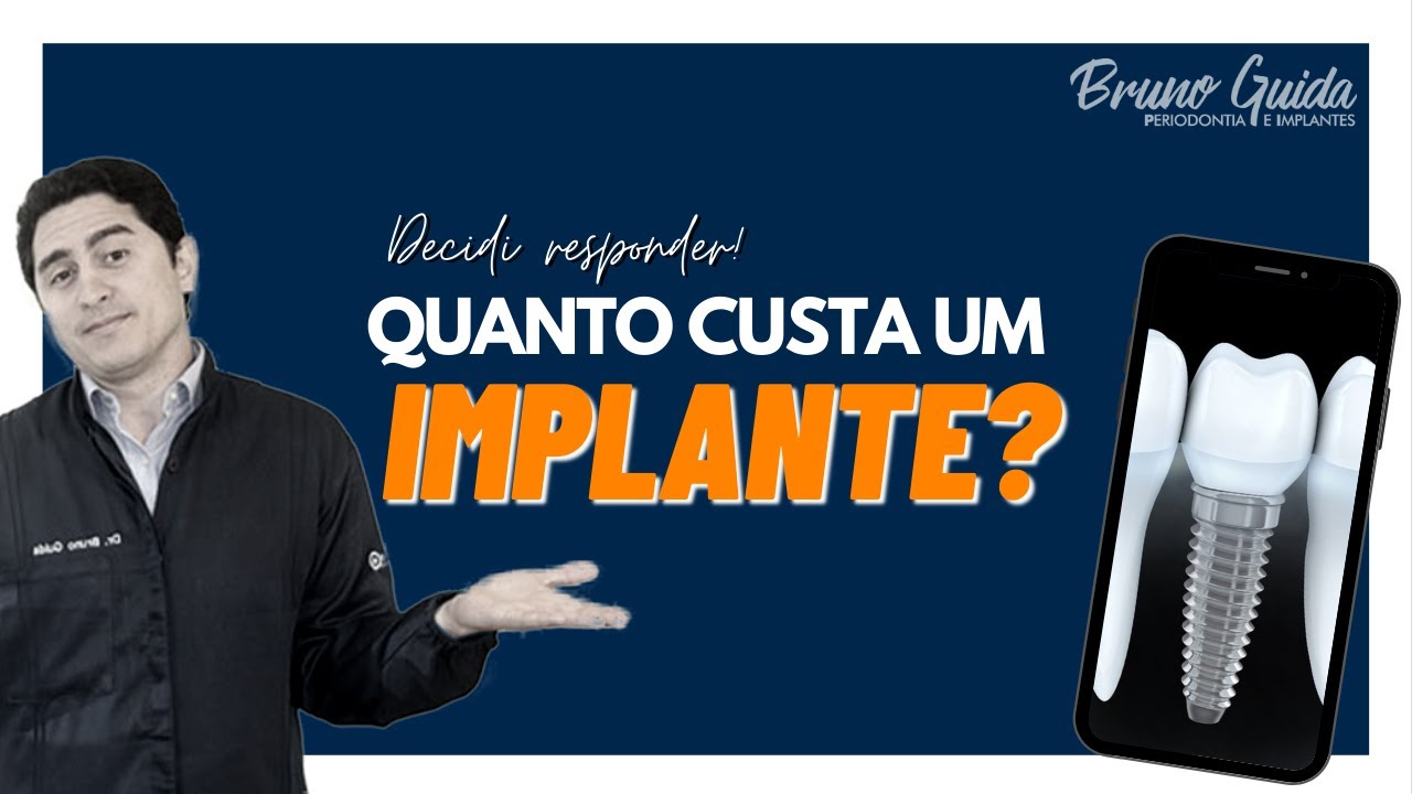 Qual o valor de um IMPLANTE DENT&Aacute;RIO? De tanto me perguntarem, resolvi responder!