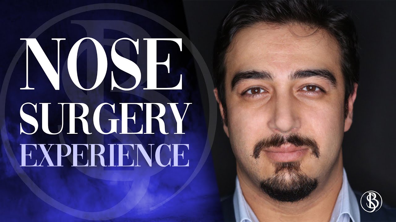 Experience of a Nose Surgery I Dr. Salih Onur Basat