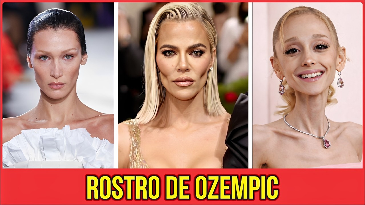 25 Celebridades que sufren del “rostro Ozempic”