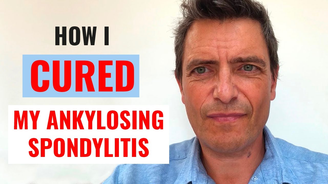 My story of how I healed from ankylosing spondylitis without drugs  #ankylosingspondylitis #story