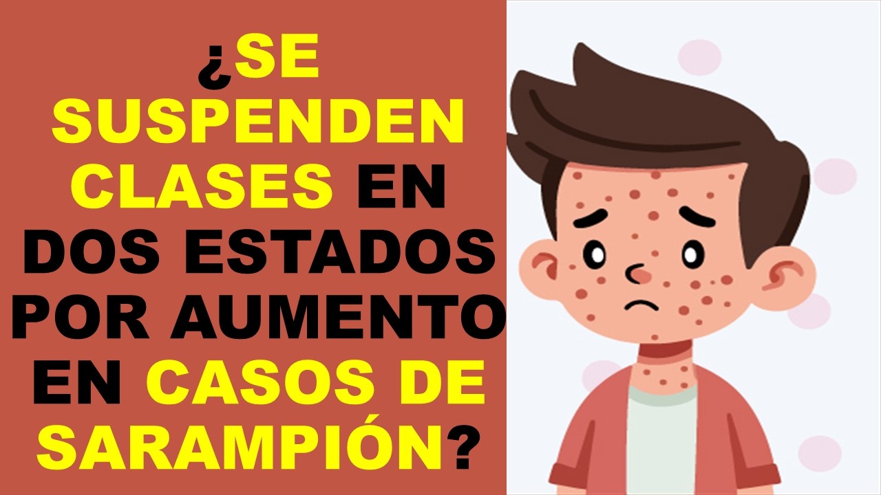 Soy Docente: ¿SE SUSPENDEN CLASES EN DOS ESTADOS POR AUMENTO EN CASOS DE SARAMPIÓN?