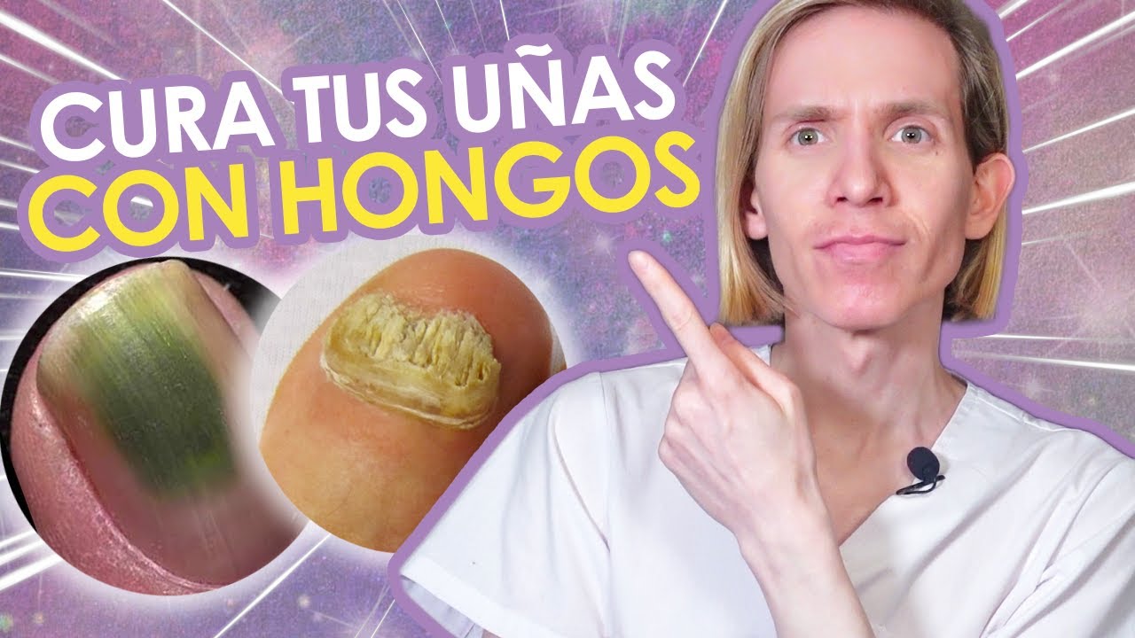 COMO CURAR LOS HONGOS EN LAS UÑAS - Guía para resolver Onicomicosis de manos y pies - Simon Scarano