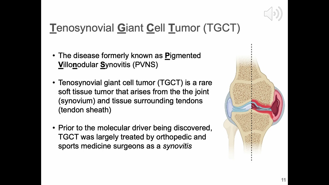 Wecome to TGCT Day of Learning Colorado and TGCT 101
