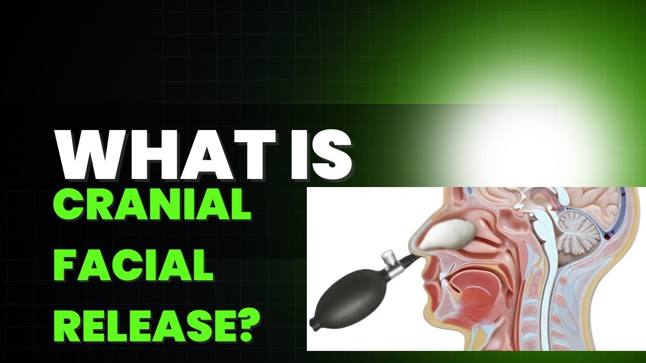 What is cranial facial release?