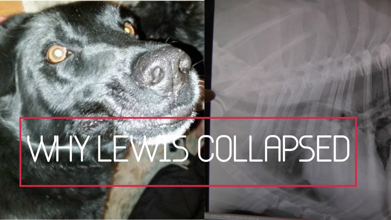 Why Did Lewis Collapse?