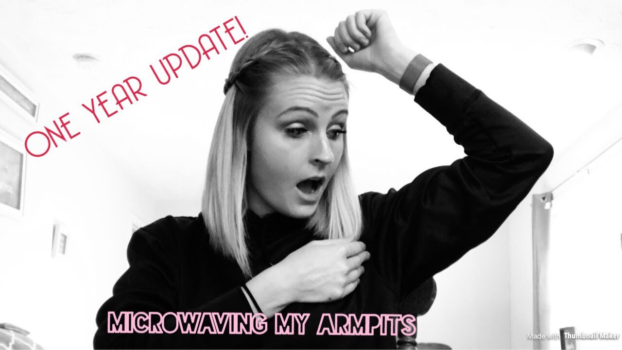 I MICROWAVED MY ARMPITS! Miradry Update | 1 Year Later