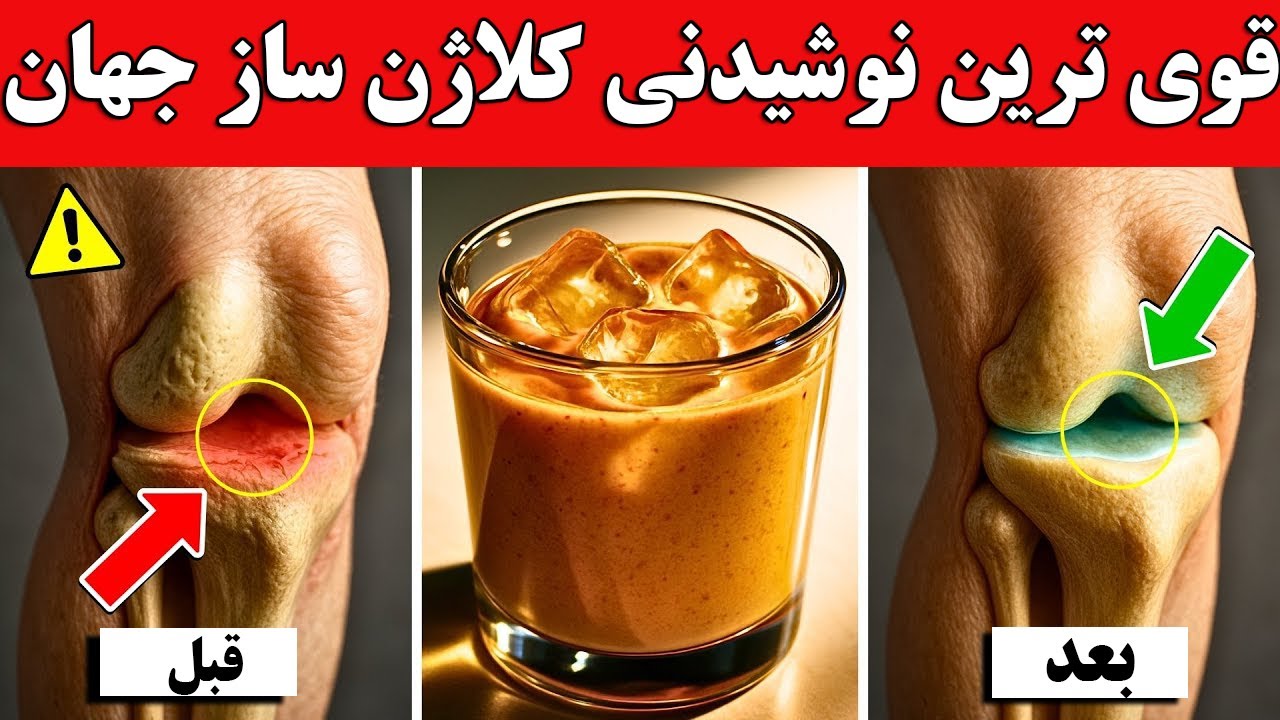 قوی ترین نوشیدنی کلاژن ساز جهان !‌ مفاصل و غضروف ها رو دوباره بساز