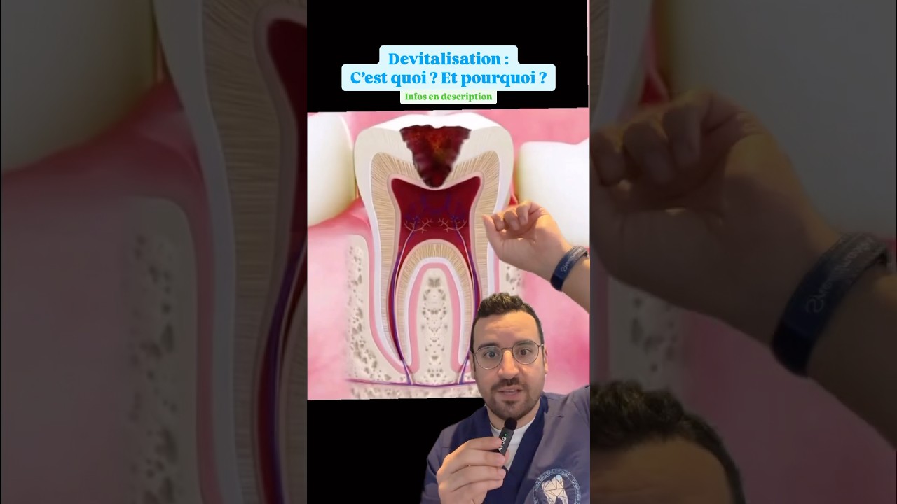 Pourquoi faut-il d&eacute;vitaliser une dent ? C&rsquo;est quoi la d&eacute;vitalisation ?
