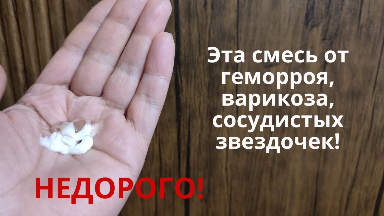 Простой рецепт мази! Помогает при геморрое, варикозе, сосудистых звездочках, отеках! Своими руками!