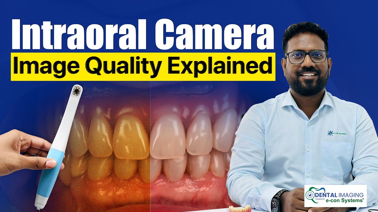 What Image Quality Really Means in Intraoral Cameras | Dental Imaging Series &ndash; EP 2 | e-con Systems