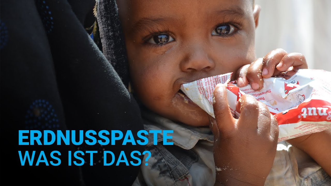 Erdnusspaste gegen Hunger: Was ist das?