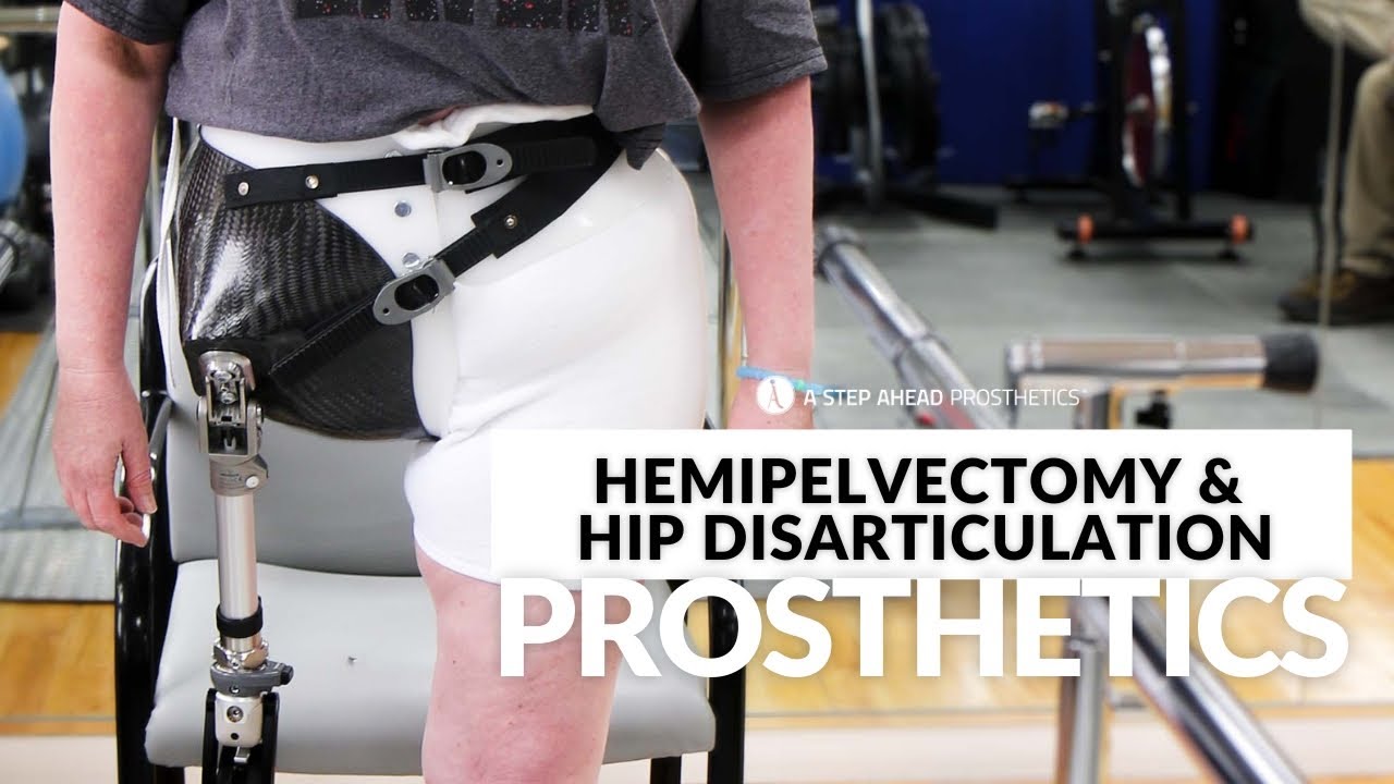 Hip Disarticulation & Hemipelvectomy Patients Walking with Custom Prosthetics