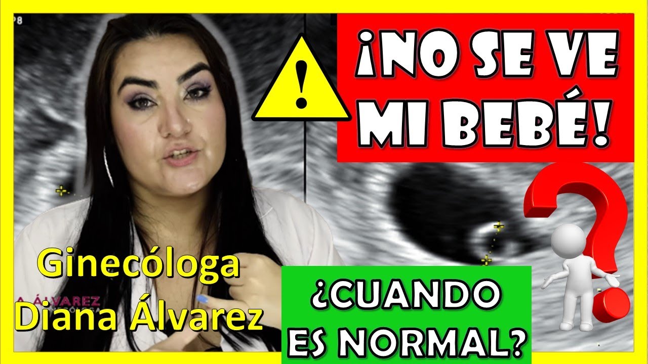⚠SACO GESTACIONAL SIN BEBÉ❗, ¿Hasta cuando es NORMAL❓   por GINECOLOGA DIANA ALVAREZ