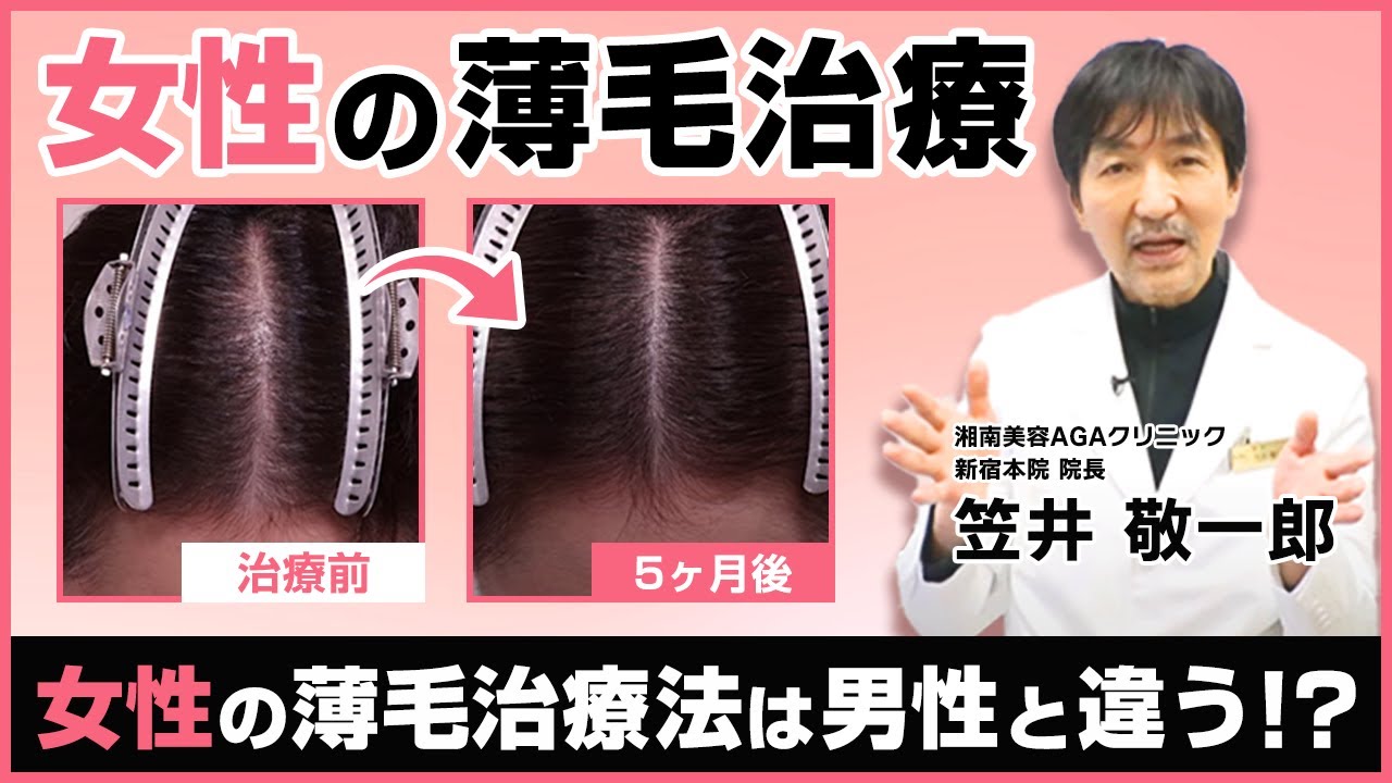 【女性の薄毛（AGA）治療】効果的な治療は？女性と男性では薄毛の原因や対策が違うんです【AGA治療・脱毛症】【湘南美容クリニック】